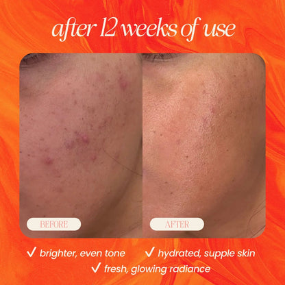 Pineapple &amp; Rosehip Vitamin C Serum 