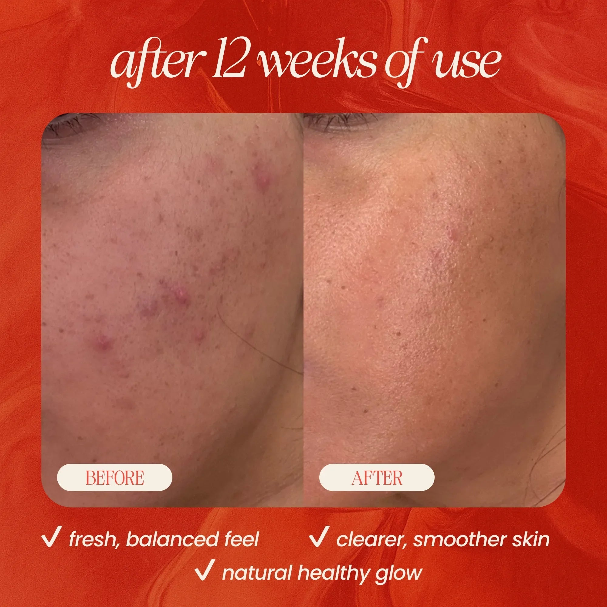 Peach &amp; Basil Balancing Face Cleanser 