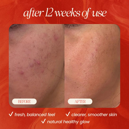 Peach &amp; Basil Balancing Face Cleanser 