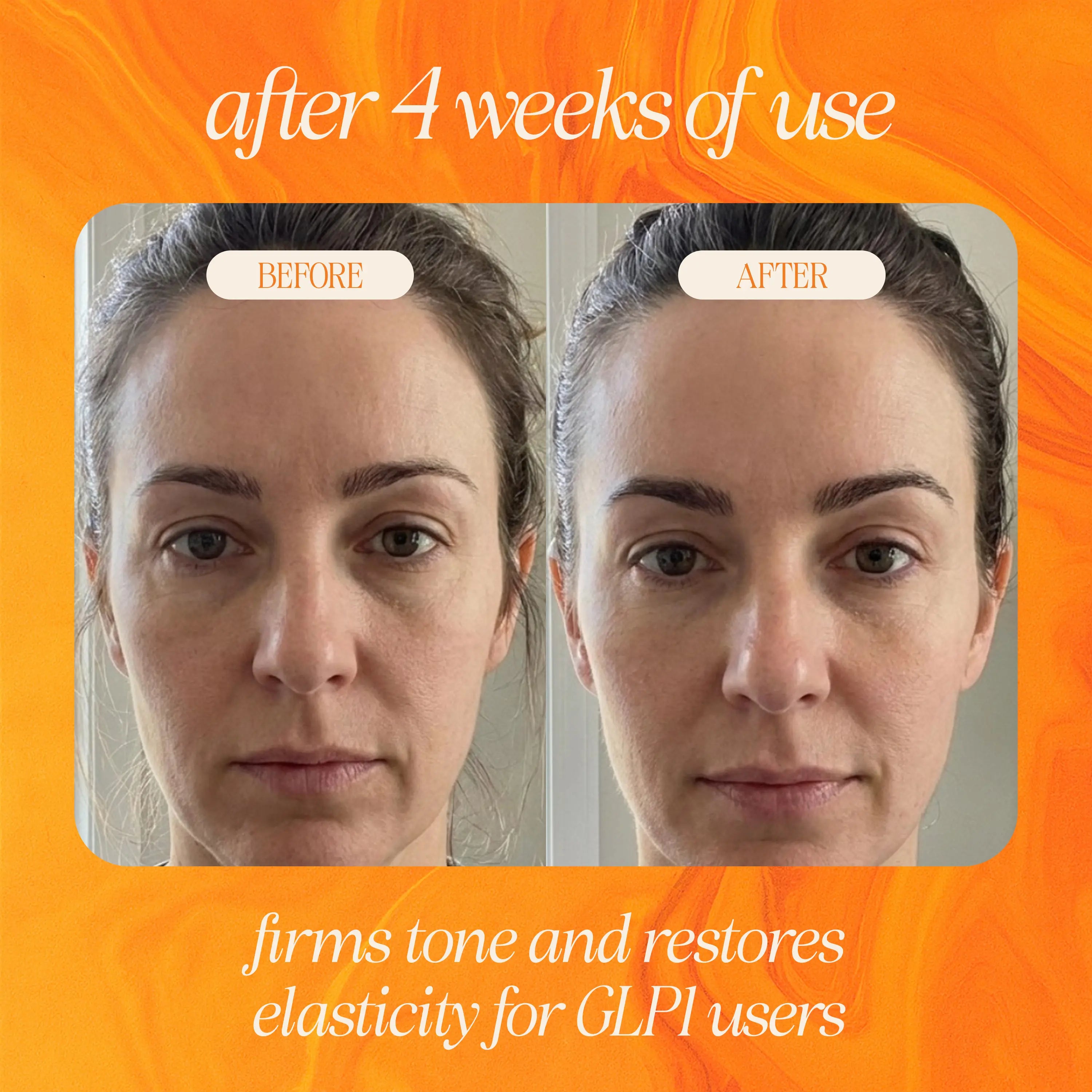Bakuchiol Skin Renewing Facial Oil (Retinol Alternative) 