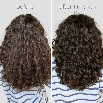 Oil Capsules For Frizzy Hair