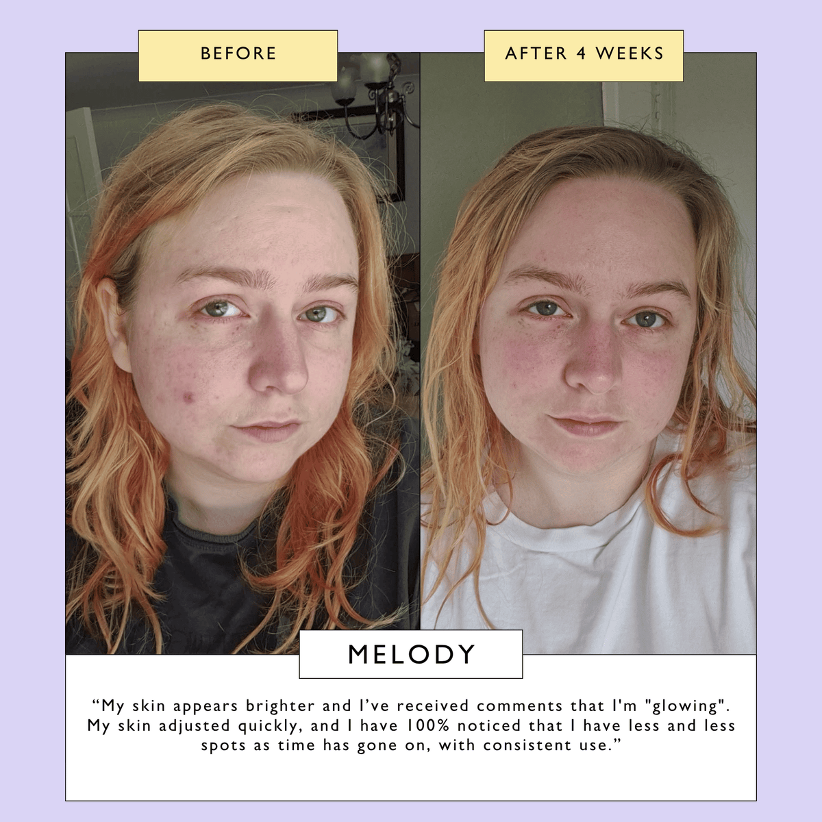 Powder to Foam Face Wash with Willow Bark + Papaya Enzymes  DestGlow