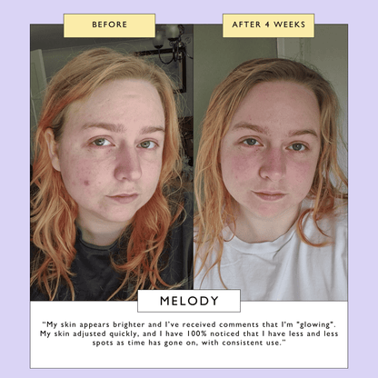 Powder to Foam Face Wash with Willow Bark + Papaya Enzymes  DestGlow
