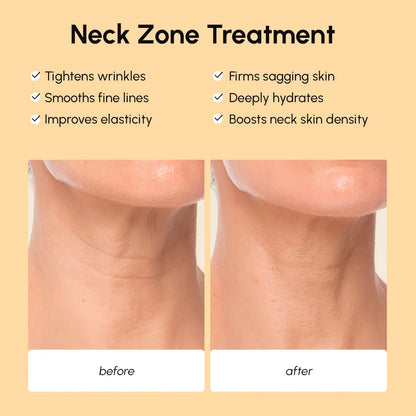 Lifting Neck Wrinkle Patches by Maree