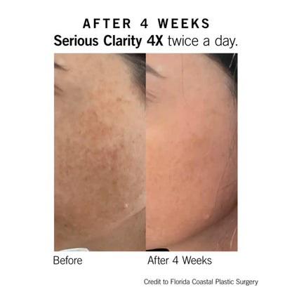 Neova Serious Clarity 4X 1 Oz by Nava Beauty