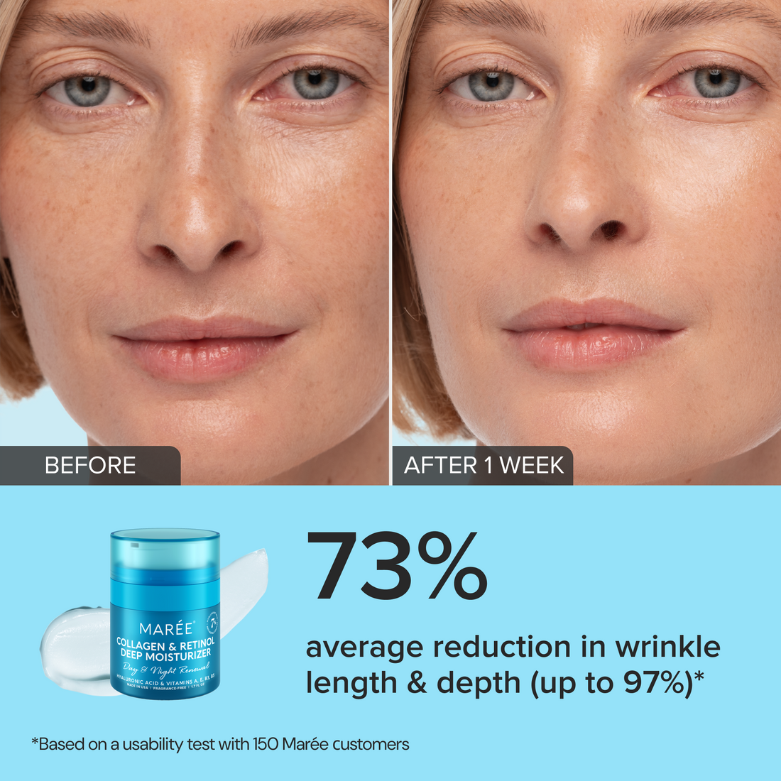 Retinol &amp; Collagen Anti-Age Cream