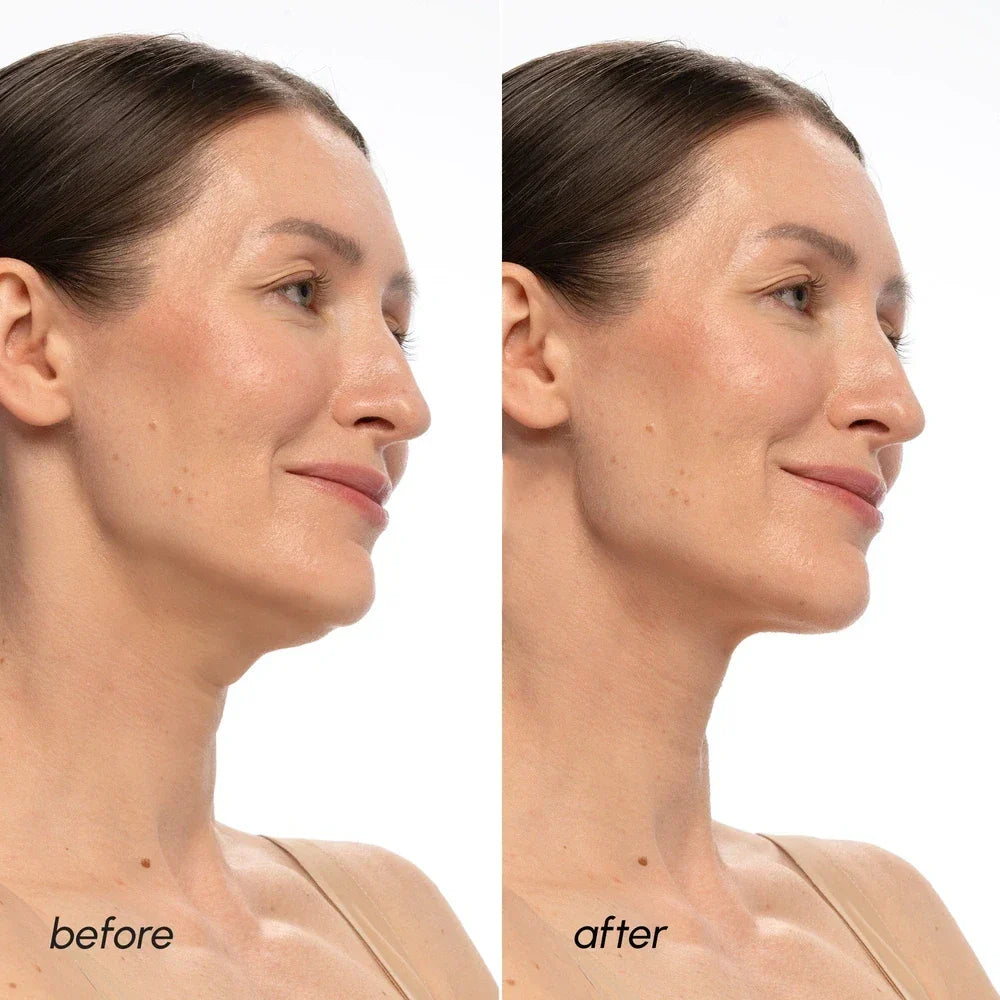 PDRN V-line Lifting Mask by Maree