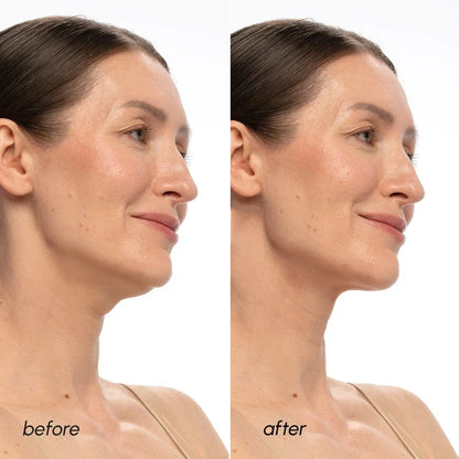 PDRN V-line Lifting Mask by Maree