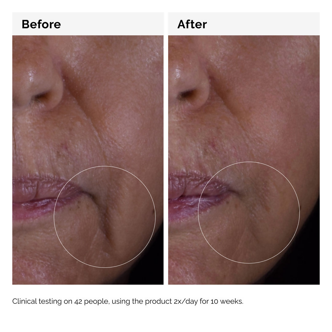 The Ordinary Growth Factors Solution 15% Serum