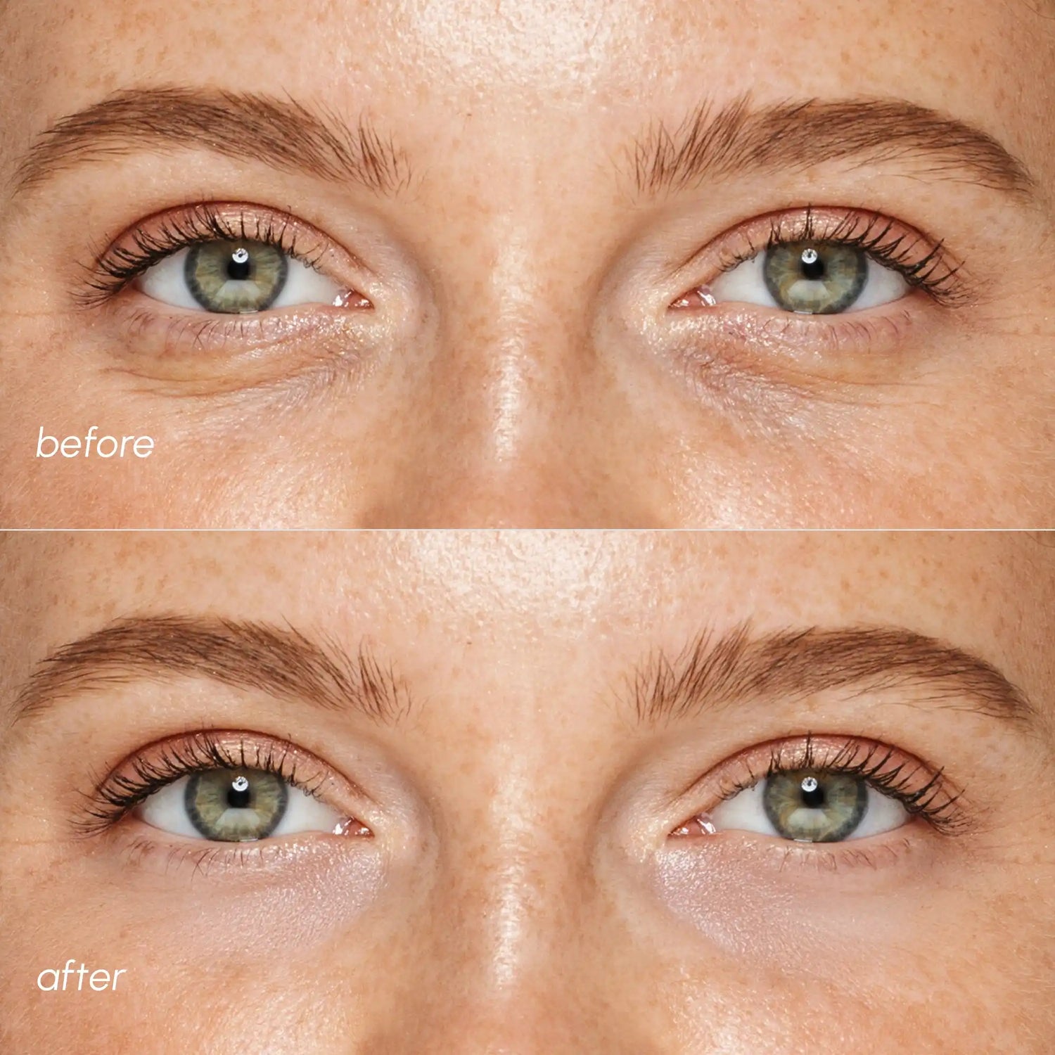 Pink Eye Patches for Puffy Eyes by Maree