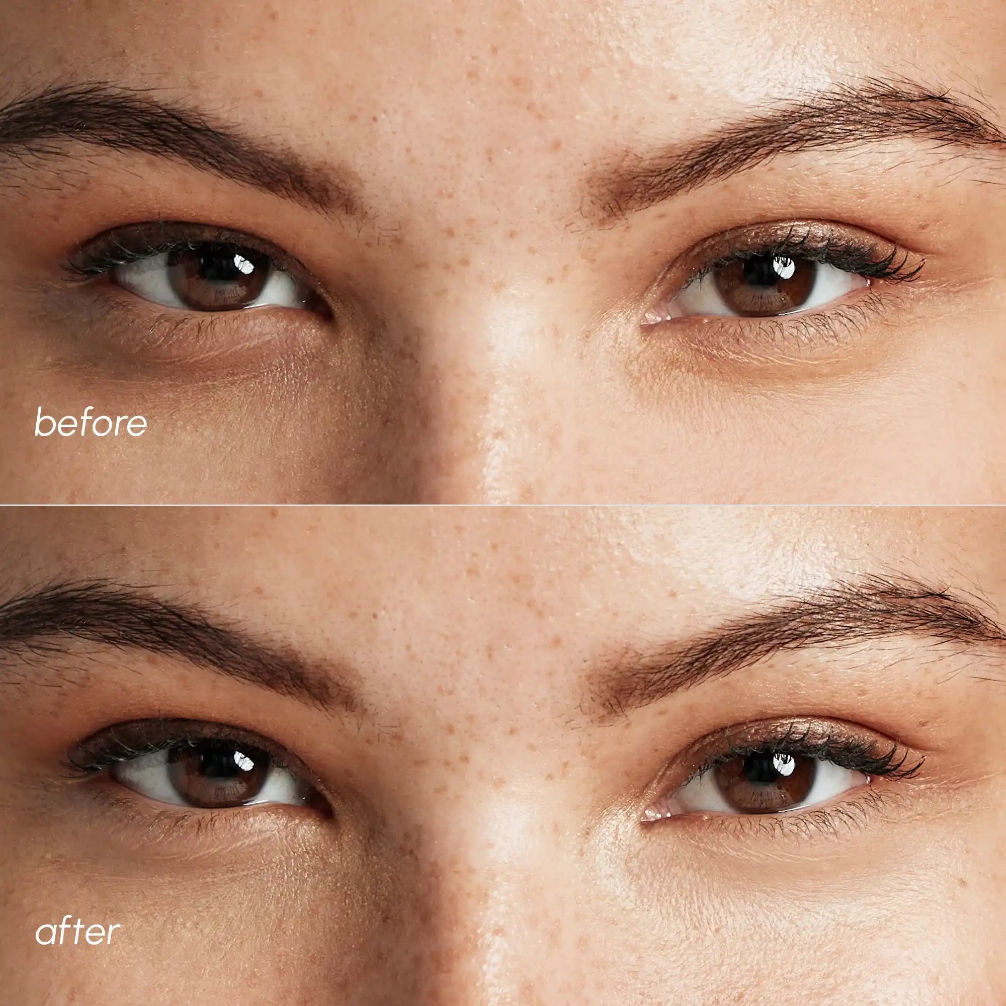 Pink Eye Patches for Puffy Eyes by Maree