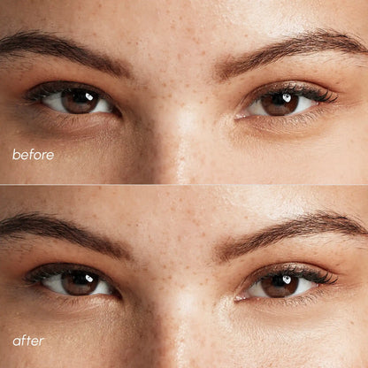 Pink Eye Patches for Puffy Eyes by Maree