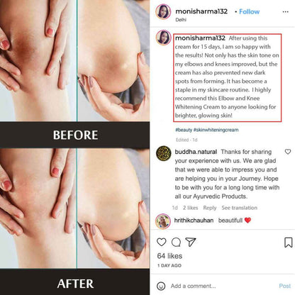 Buddha Natural Elbow and Knee Whitening Cream