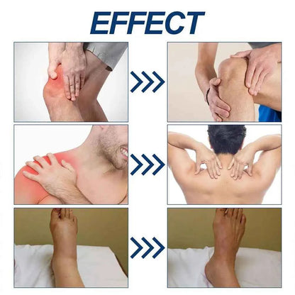 Pain Relief Cream for Lumbar Knee Soreness, Arthritis &amp; Sciatica Treatment