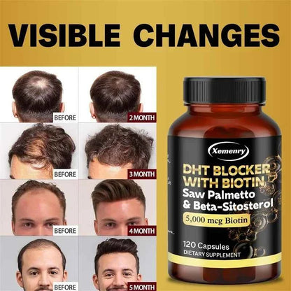 Saw Palmetto Extract Capsules - Prostate Health,Blocker Hair Growth for Mens Help Urination Frequency Supple - 120 Capsules