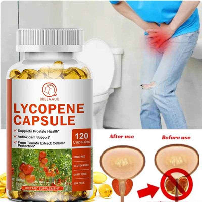 BEWORTHS Lycopene Capsules Support Prostate and Bladder Health, Alleviate Urinary Tract Pain, Male Reproductive Health Support
