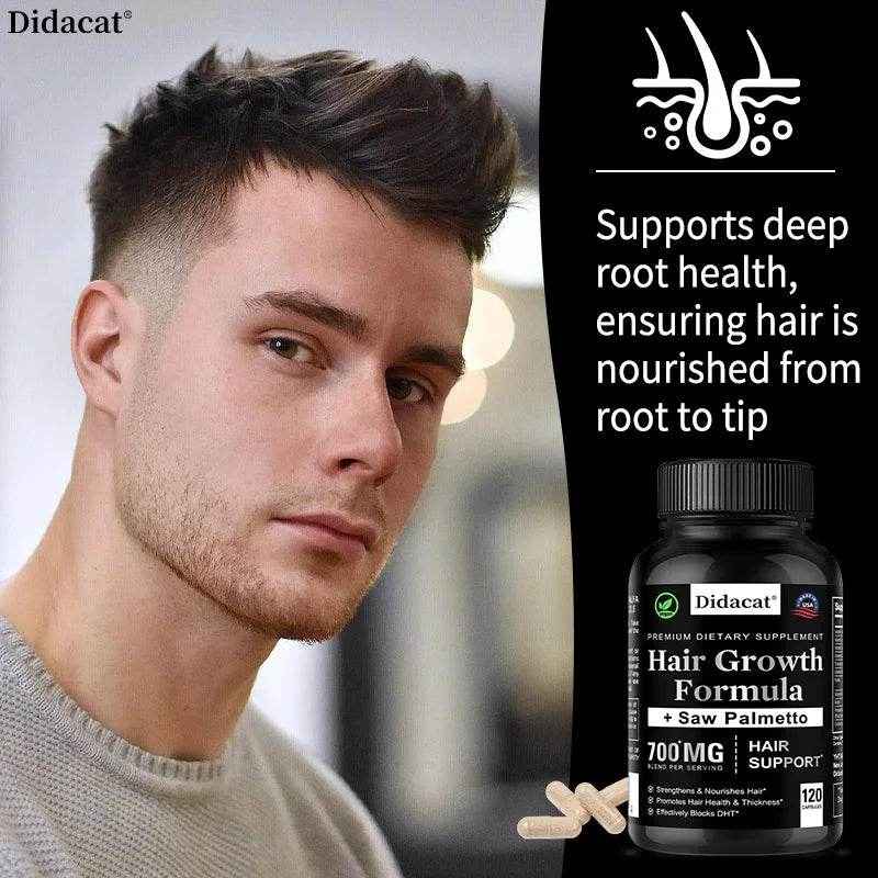 Hair Loss Supplements for Men &amp; Women with Biotin - Saw Palmetto Supplements for Healthy and Strong Hair - Promotes Hair Growth