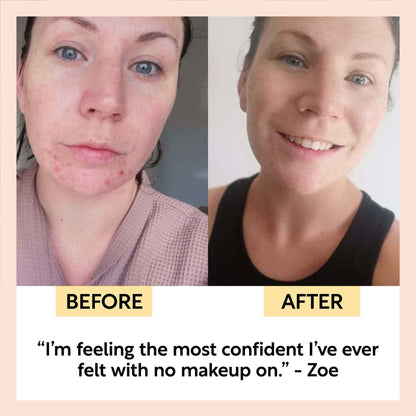 Travel-Size Skincare Bundle