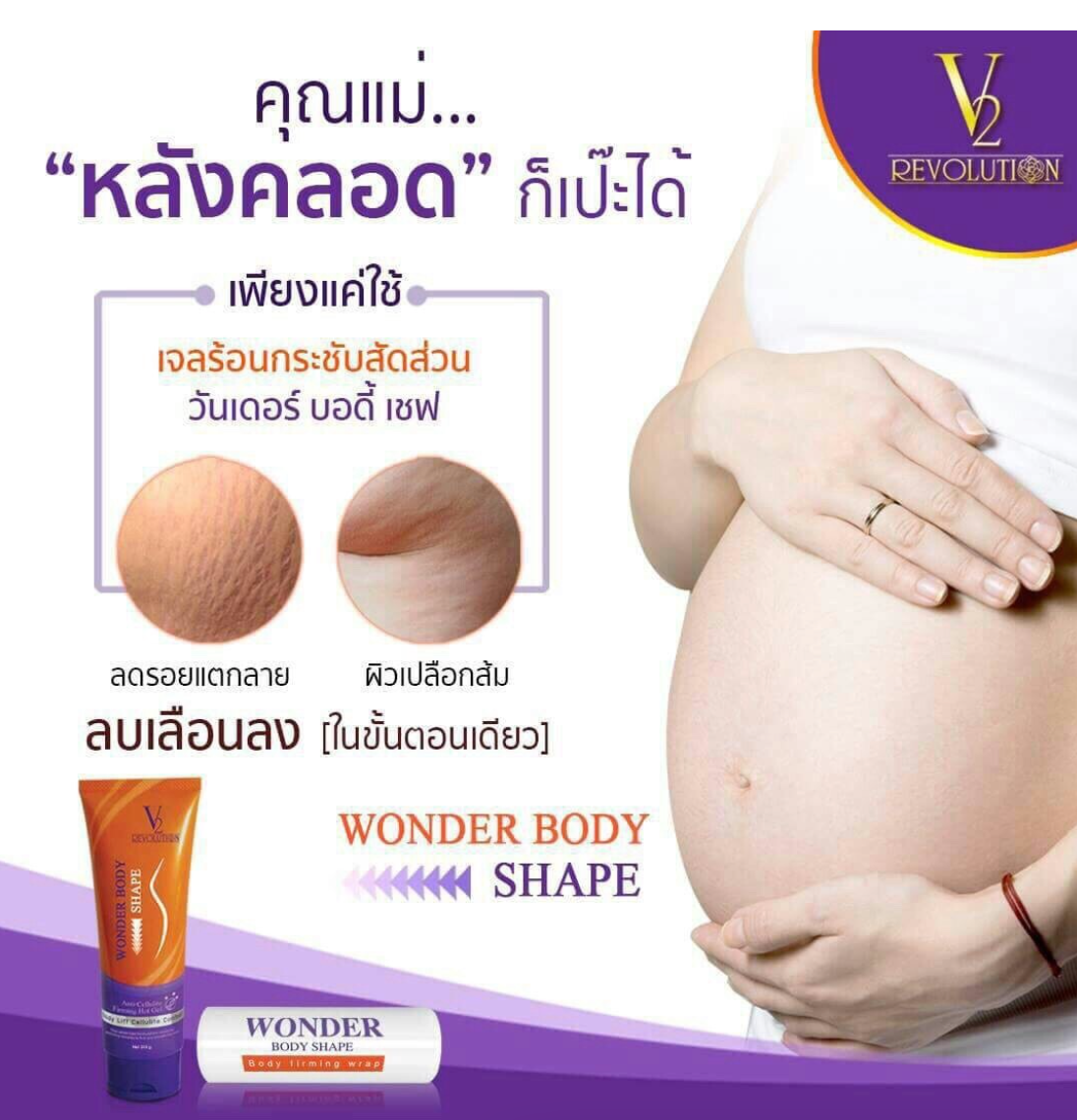 V2 Revolution Stretch Mark &amp; Cellulite Solution