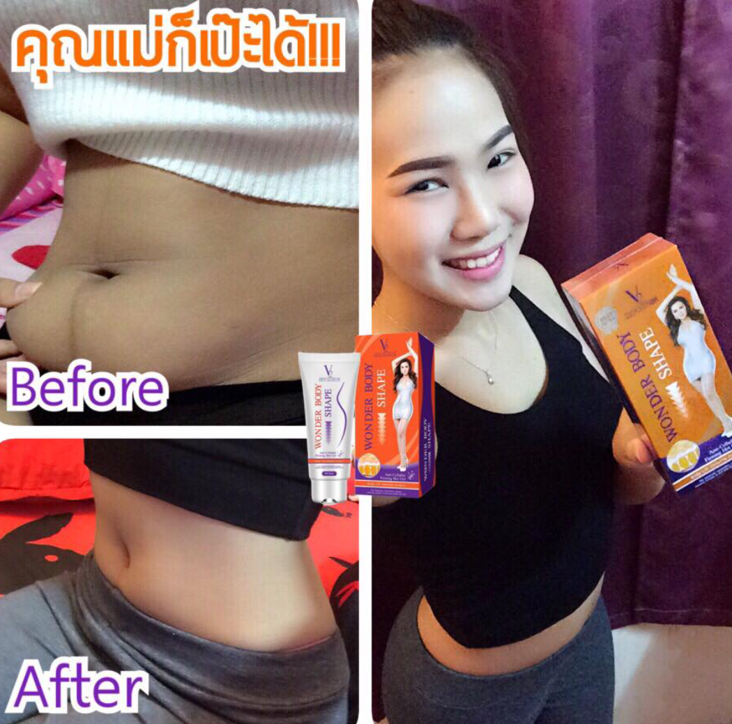 V2 Revolution Stretch Mark &amp; Cellulite Solution