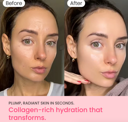 QUIA Collagen Jelly Cream with Niacinamide