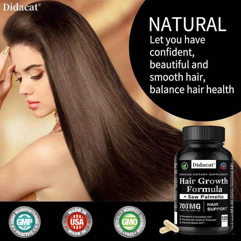 Hair Loss Supplements for Men &amp; Women with Biotin - Saw Palmetto Supplements for Healthy and Strong Hair - Promotes Hair Growth