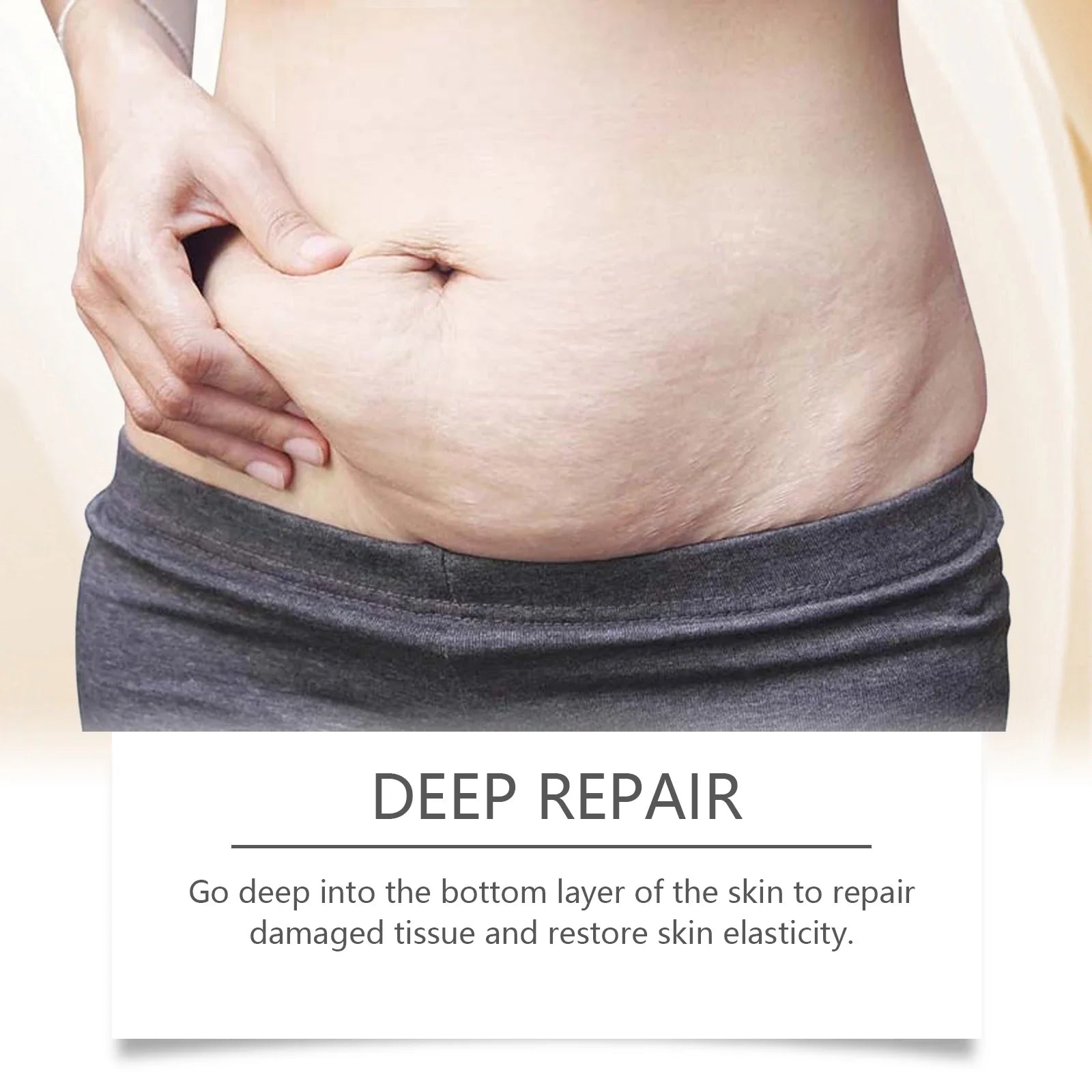 Stretch Mark Lightening Essential Oil Skin Care Cream for Pregnant Women Moisturizing Lifting Firming Skin Slimming Oil 100ml by Roksy