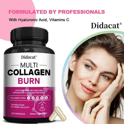 Didacat Multi-Collagen Burn - Hair, Nails, Skin, Joints, Teeth and Gum Health, Boost Metabolism, Burn Fat