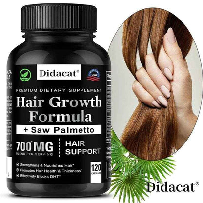 Hair Loss Supplements for Men &amp; Women with Biotin - Saw Palmetto Supplements for Healthy and Strong Hair - Promotes Hair Growth