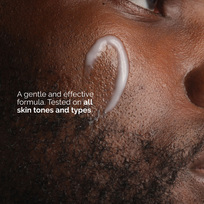 The Ordinary Niacinamide 5% Face &amp; Body Emulsion