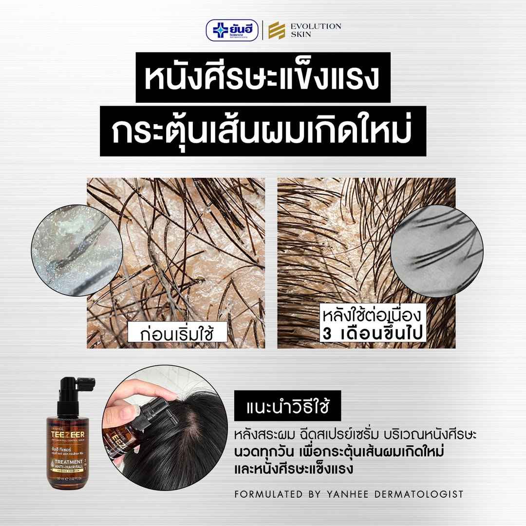 Yanhee Teezeer Anti Hair Fall Nourishes Hair Roots Control Serum 60 ml