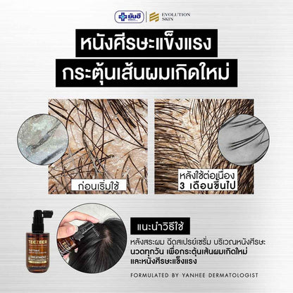 Yanhee Teezeer Anti Hair Fall Nourishes Hair Roots Control Serum 60 ml