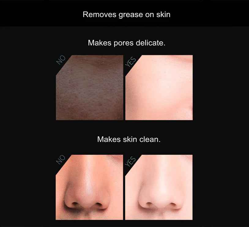 Volcanic Stone Oil-Absorbing Face Roller