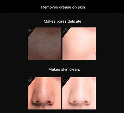 Volcanic Stone Oil-Absorbing Face Roller