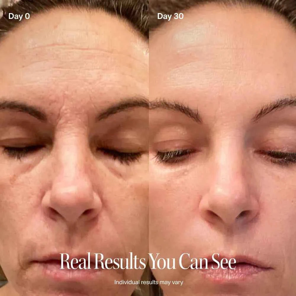 4-in-1 Red Light Therapy Wand &amp; Activating Serum Kit