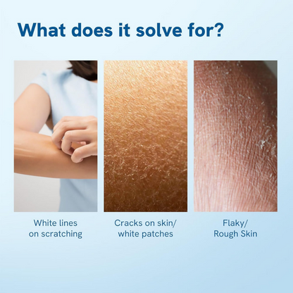 BeBodywise 10% Urea Body Lotion