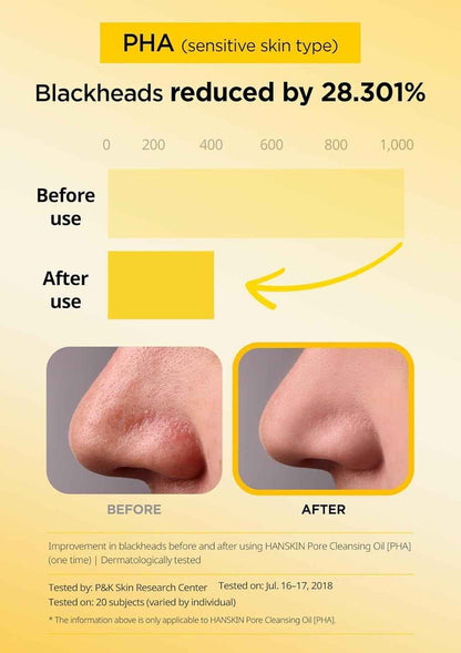 Pore Cleansing Oil, Oil Cleanser for Face, Makeup Blackhead Remover, Korean Cleanser for Sensitive Skin [PHA] (10.14 Oz)