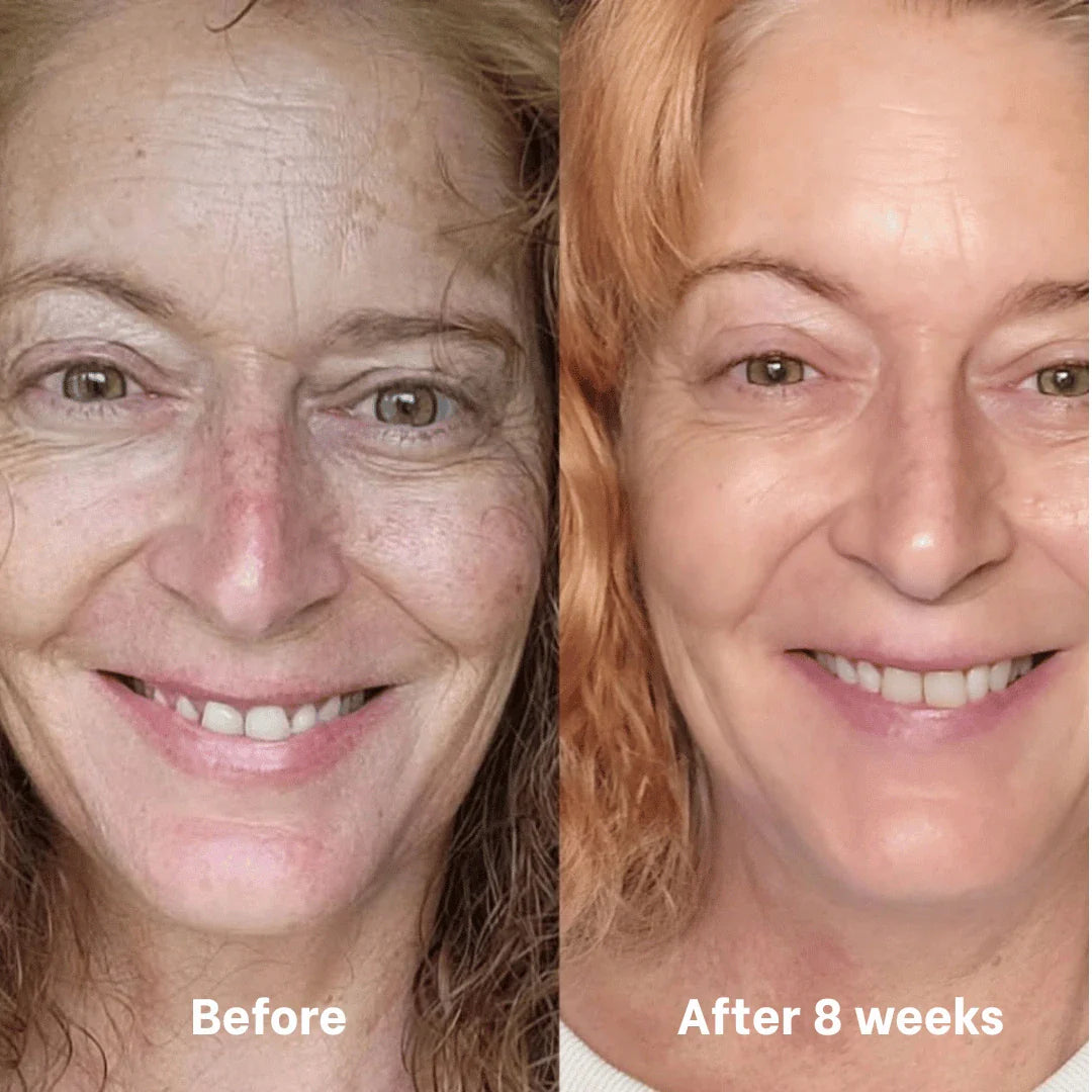 Collagen &amp; Niacinamide wrapping mask by Skynflow