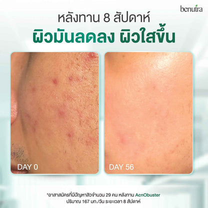 BENUTRA TETRA SOD with Astaxanthin CoQ10 Antioxidant Power for Skin Health