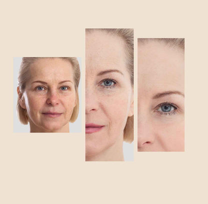 The Eraser Spot Cream | Dark Spot Corrector