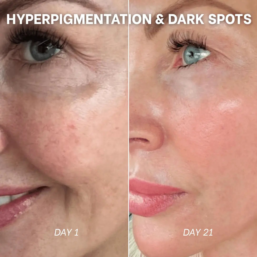 PDRN Collagen Peptide Hydrogel Mask