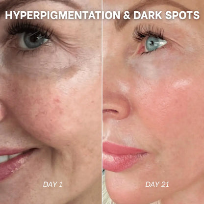 PDRN Collagen Peptide Hydrogel Mask