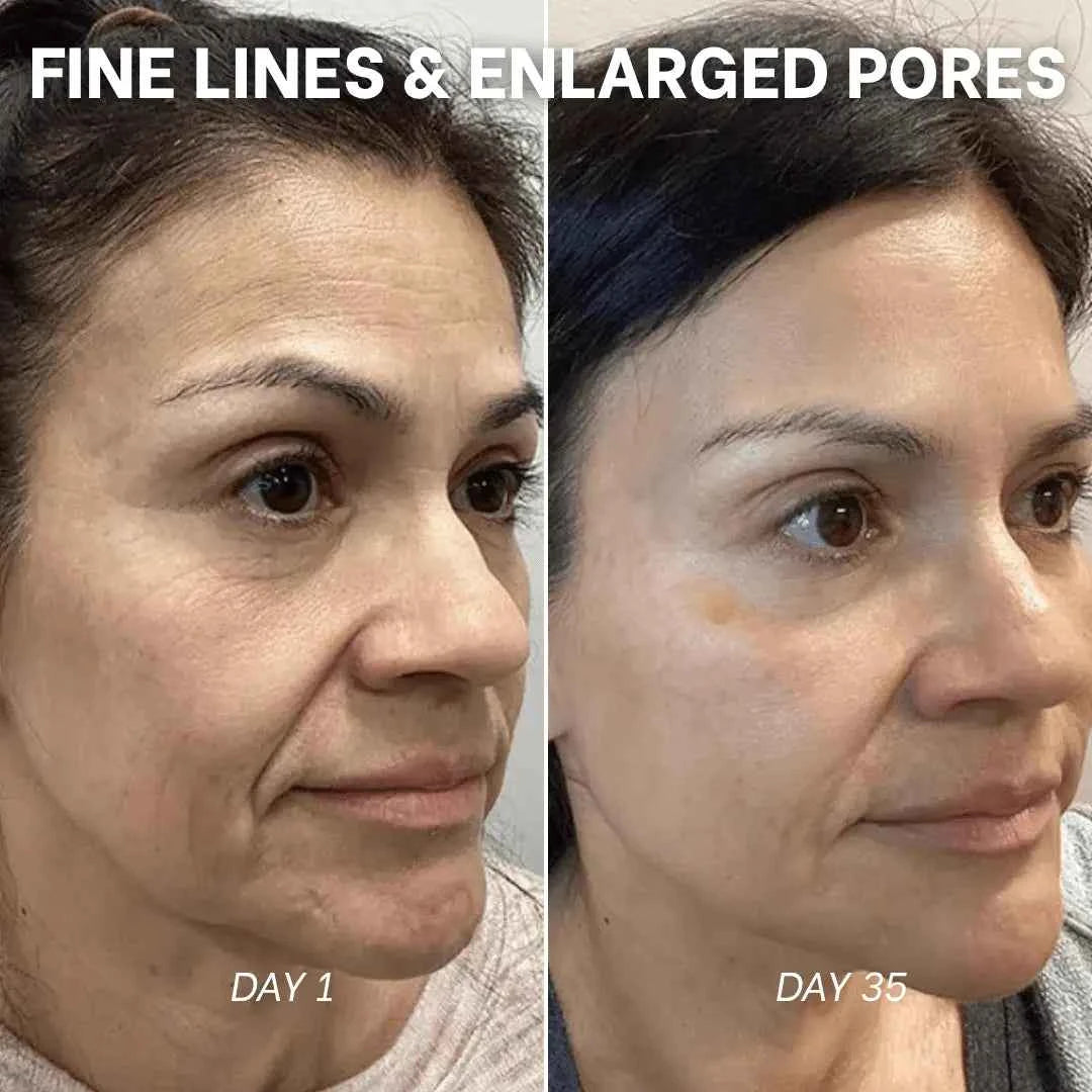 PDRN Collagen Peptide Hydrogel Mask