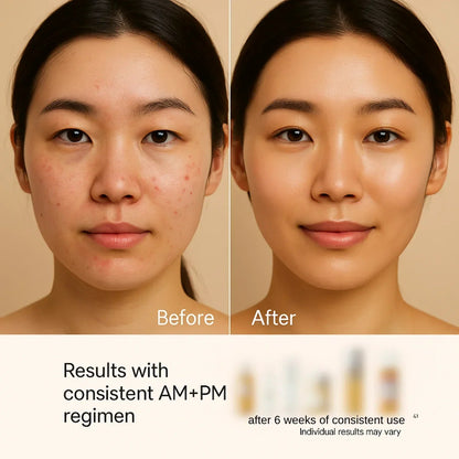 Full-Size Korean Skincare Set for Dark Spots, Fine Lines &amp; Glass Skin