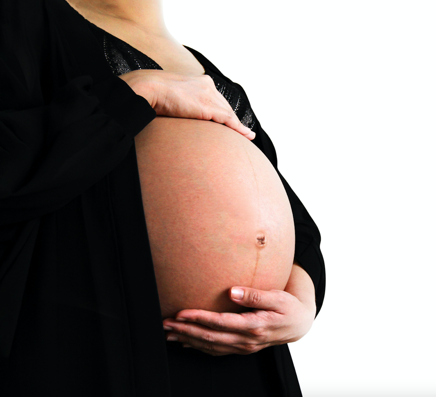 V2 Revolution Stretch Mark &amp; Cellulite Solution