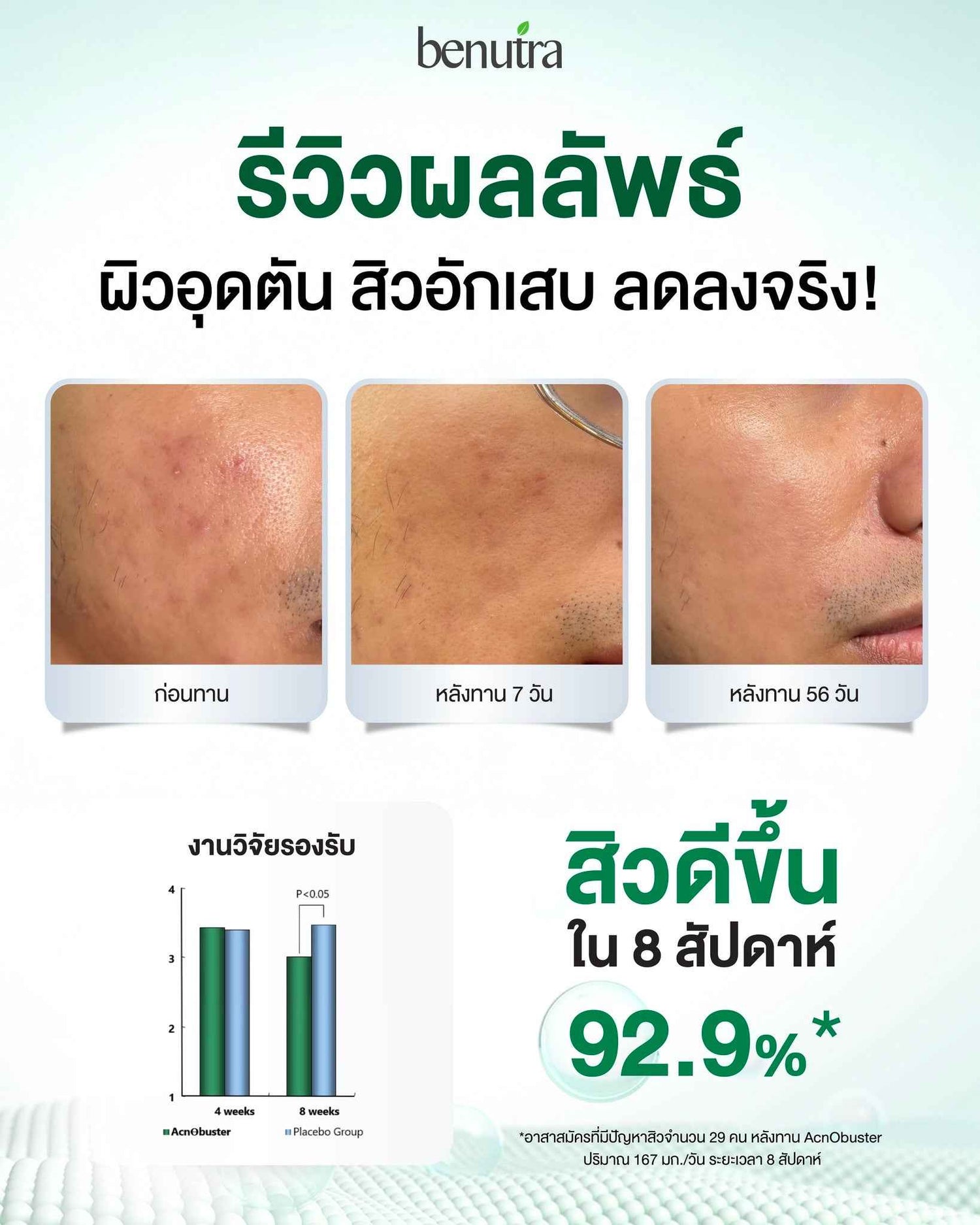 BENUTRA TETRA SOD with Astaxanthin CoQ10 Antioxidant Power for Skin Health