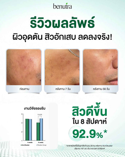 BENUTRA TETRA SOD with Astaxanthin CoQ10 Antioxidant Power for Skin Health