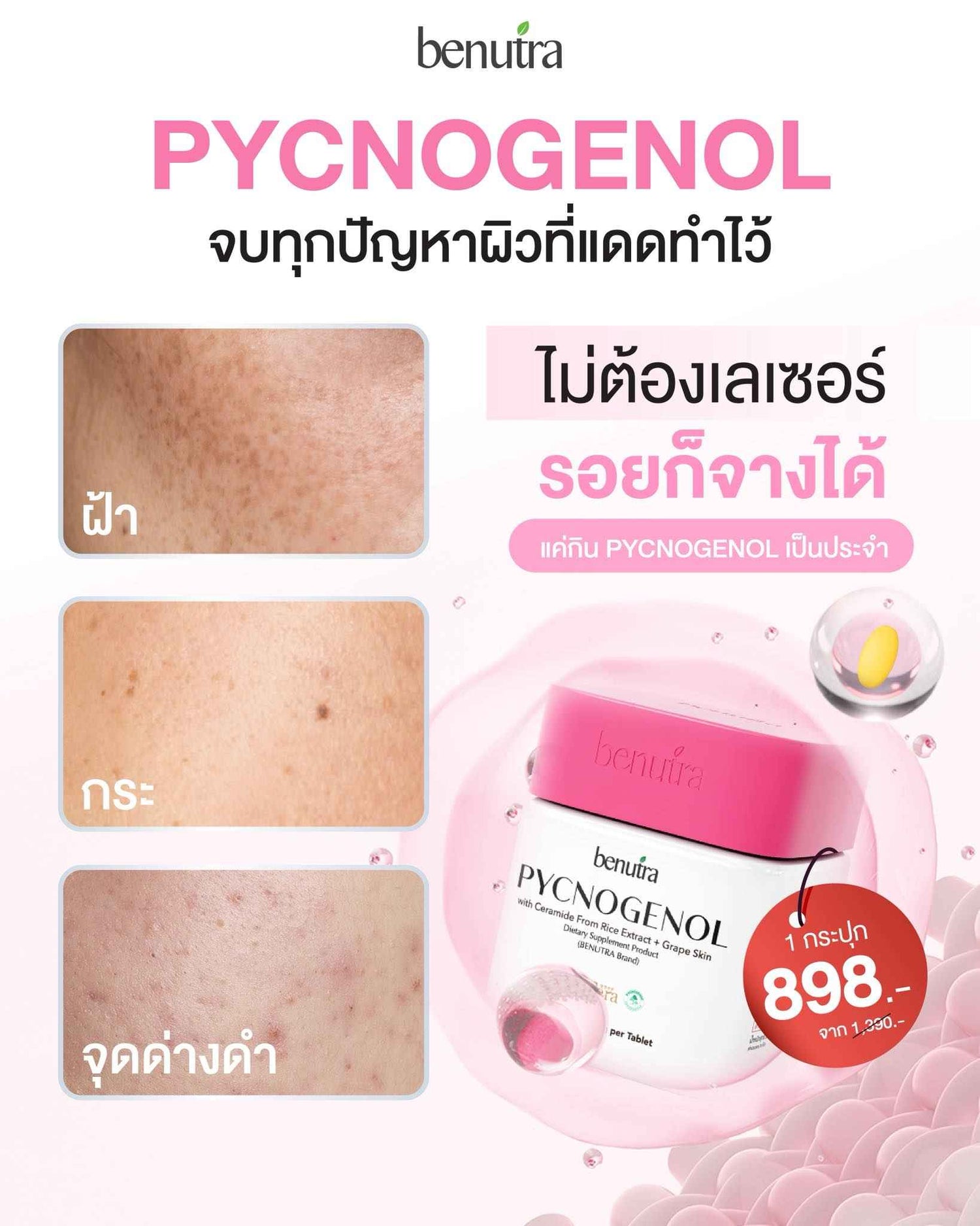 BENUTRA TETRA SOD with Astaxanthin CoQ10 Antioxidant Power for Skin Health