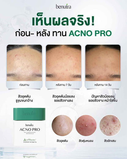 BENUTRA TETRA SOD with Astaxanthin CoQ10 Antioxidant Power for Skin Health