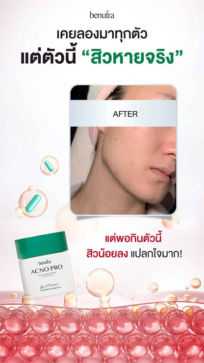 BENUTRA TETRA SOD with Astaxanthin CoQ10 Antioxidant Power for Skin Health